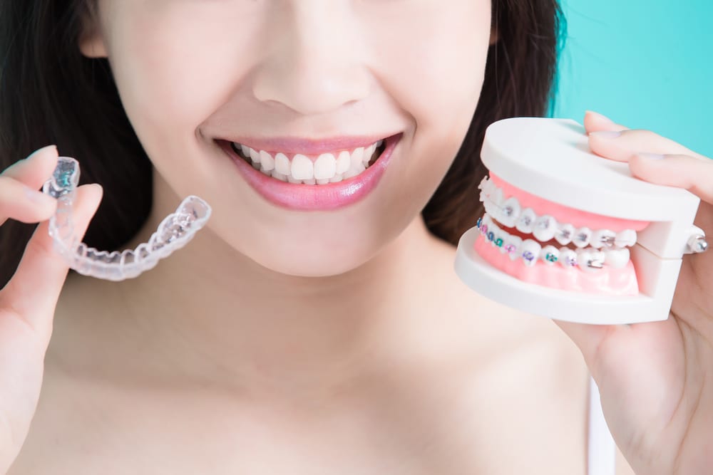 Advantages of Invisalign