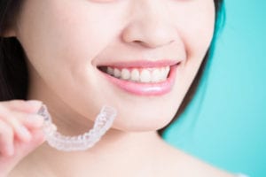 Reseda Invisalign