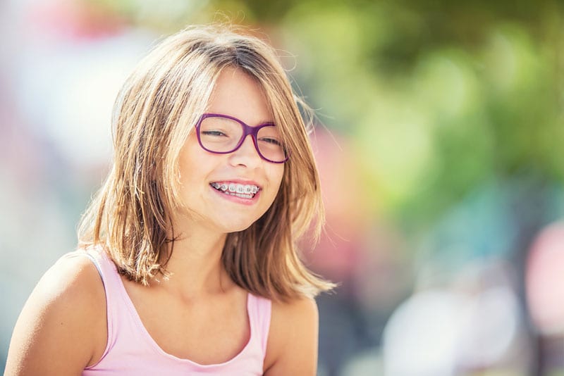 select clear braces in Encino