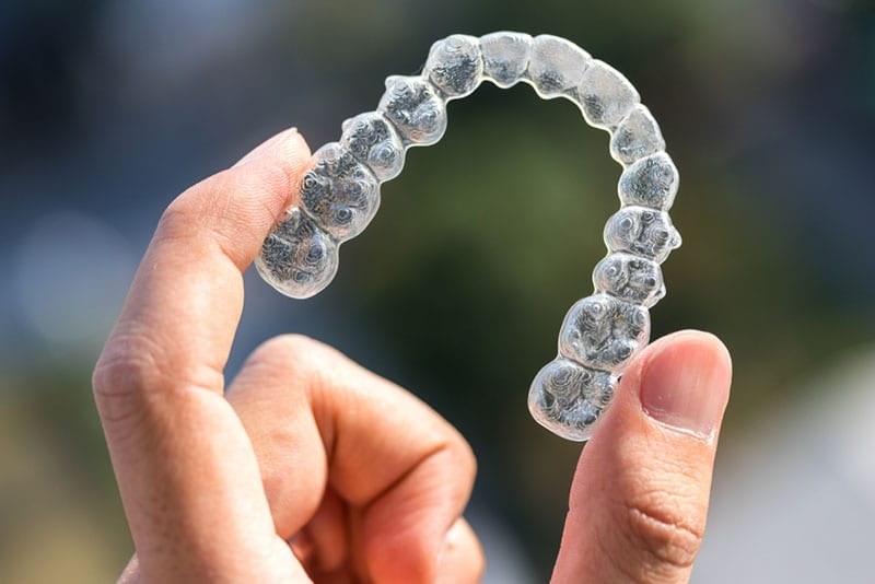 clear braces dentist in encino