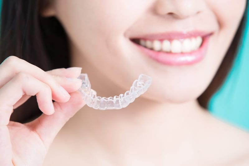 Are You Considering Encino Clear Braces