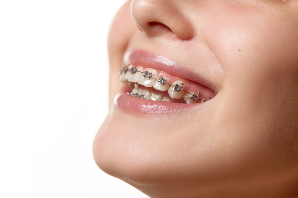 Encino orthodontist